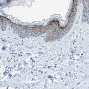 Anti-SDC1 antibody produced in rabbit，100UL，HPA006185-100UL，Sigma
