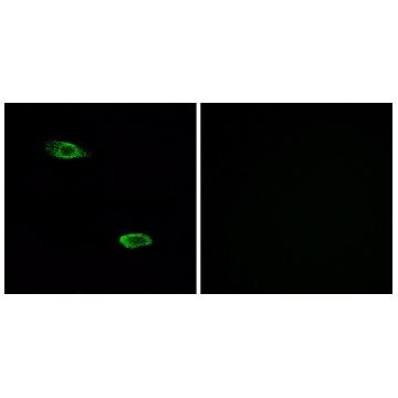Anti-OR51E2 antibody produced in rabbit，100UG，SAB4503227-100UG，Sigma