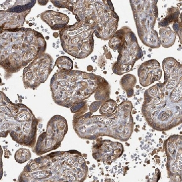 Anti-STARD4 antibody produced in rabbit，100UL，HPA048081-100UL，Sigma
