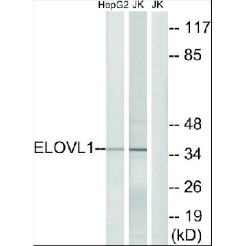 Anti-ELOVL1 antibody produced in rabbit，100UL，SAB4300768-100UL，Sigma