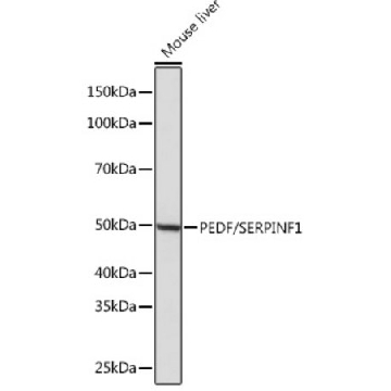 Anti-PEDF/SERPINF1 Antibody, clone 4H0C5, Rabbit Monoclonal，100UL，SAB5702393-100UL，Sigma