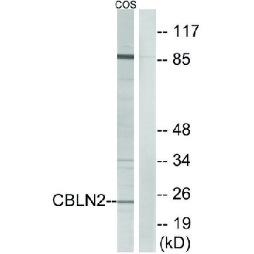 Anti-CBLN2 antibody produced in rabbit，100UG，SAB4500522-100UG，Sigma