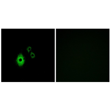Anti-KCNJ5 antibody produced in rabbit，100UG，SAB4501633-100UG，Sigma