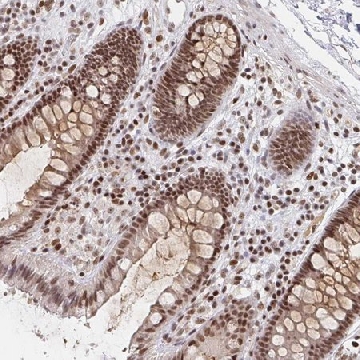 Anti-H1FX antibody produced in rabbit，100UL，HPA040099-100UL，Sigma