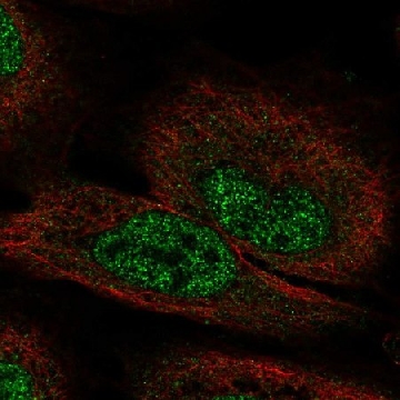 Anti-FGF12 antibody produced in rabbit，100UL，HPA071557-100UL，Sigma