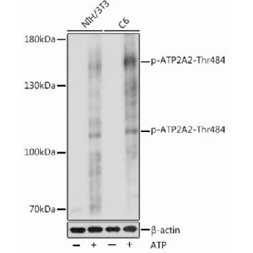 Anti-Phospho-ATP2A2-Thr484 antibody produced in rabbit，100UL，SAB5700576-100UL，Sigma