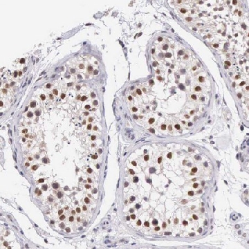 Anti-HMGXB4 antibody produced in rabbit，100UL，HPA000725-100UL，Sigma