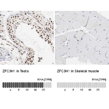 Anti-ZFC3H1 antibody produced in rabbit，100UL，HPA007151-100UL，Sigma