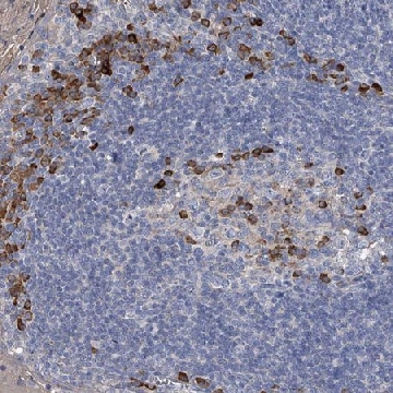 Anti-CCR4 antibody produced in rabbit，100UL，HPA031613-100UL，Sigma