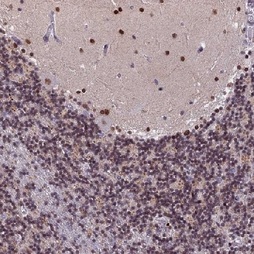 Anti-CDC7 antibody produced in rabbit，100UL，HPA035831-100UL，Sigma