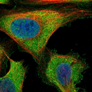 Anti-ZNF598 antibody produced in rabbit，100UL，HPA041760-100UL，Sigma