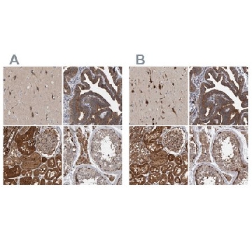 Anti-KIAA0753 antibody produced in rabbit，100UL，HPA023494-100UL，Sigma