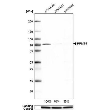 Anti-PRMT5 antibody produced in rabbit，100UL，HPA005525-100UL，Sigma