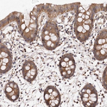 Anti-PANK4 antibody produced in rabbit，100UL，HPA027961-100UL，Sigma