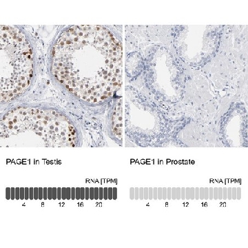 Anti-PAGE1 antibody produced in rabbit，100UL，HPA003473-100UL，Sigma