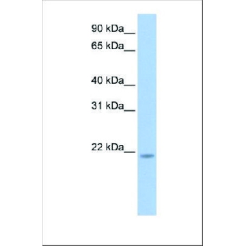 Anti-RNF5 antibody produced in rabbit，100UL，SAB2102034-100UL，Sigma