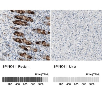 Anti-SPINK4 antibody produced in rabbit，100UL，HPA007286-100UL，Sigma