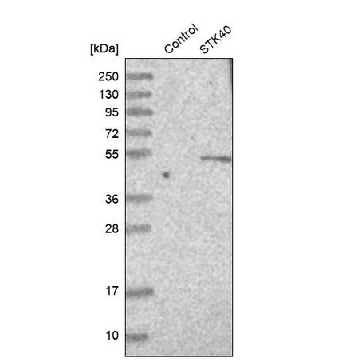 Anti-STK40 antibody produced in rabbit，100UL，HPA008026-100UL，Sigma