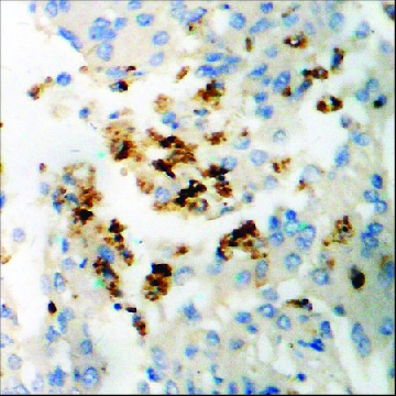 Anti-phospho-SGK (pSer⁴²²) antibody produced in rabbit，100UG，SAB4503834-100UG，Sigma