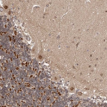 Anti-USP49 antibody produced in rabbit，100UL，HPA030254-100UL，Sigma