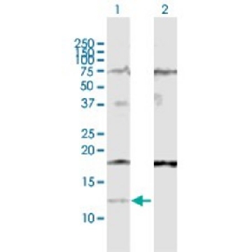 Anti-IFI27 antibody produced in rabbit，100UG，SAB1408588-100UG，Sigma
