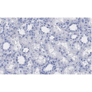 Anti-VDAC1 Antibody, clone 3M22, ZooMAb® Rabbit Monoclonal，25UL，ZRB1315-25UL，Sigma