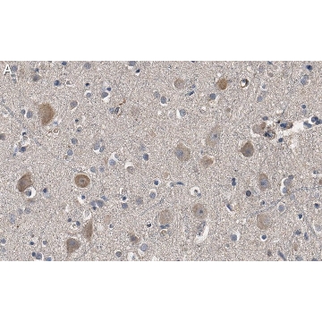 Anti-Akt Antibody, PH Domain Antibody, clone SKB1 ZooMAb® Mouse Monoclonal，4X25UL，ZMS1027-4X25UL，Sigma