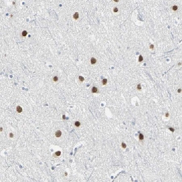 Anti-ZIC1 antibody produced in rabbit，100UL，HPA004098-100UL，Sigma