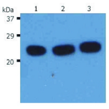 Monoclonal Anti-HRAS antibody produced in mouse，100UG，SAB4700841-100UG，Sigma