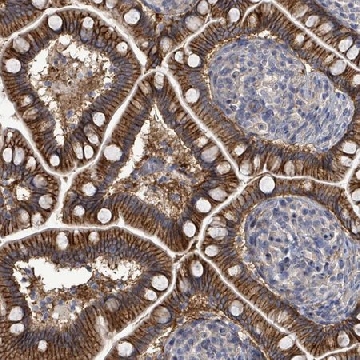 Anti-KRAS antibody produced in rabbit，100UL，HPA049830-100UL，Sigma