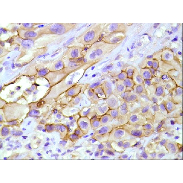 Anti-Mesothelin antibody, Rabbit monoclonal，100UL，SAB5500143-100UL，Sigma