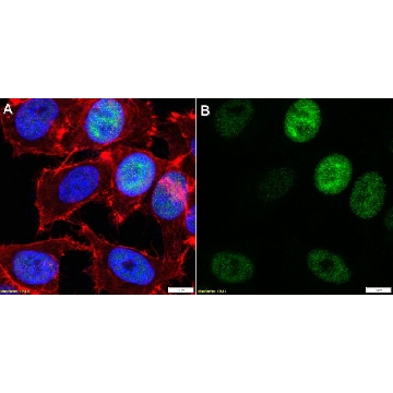 Anti-Phosphoepitope SR Antibody, clone 1H4 ZooMAb® Mouse Monoclonal，254G，ZMS1213-25UL，Sigma