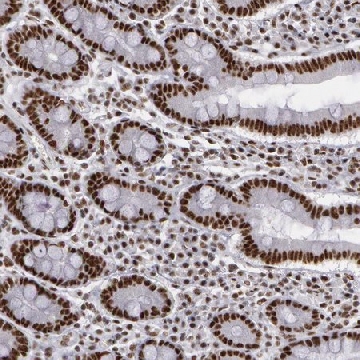 Anti-PNN antibody produced in rabbit，100UL，HPA001378-100UL，Sigma