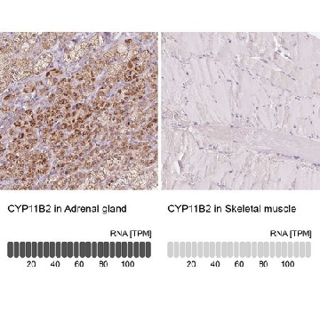 Anti-CYP11B2 antibody produced in rabbit，100UL，HPA057752-100UL，Sigma