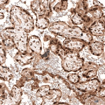 Anti-PARP14 antibody produced in rabbit，100UL，HPA012063-100UL，Sigma