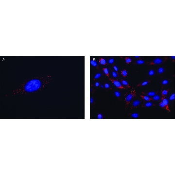 Anti-FMR1 (C-terminal) antibody produced in rabbit，200UL，F4055-200UL，Sigma
