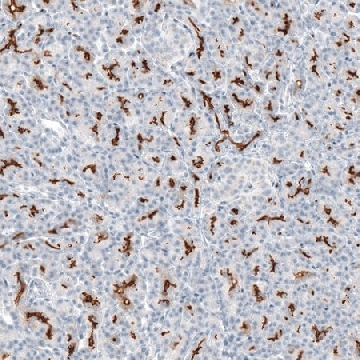 Anti-CFTR antibody produced in rabbit，100UL，HPA021939-100UL，Sigma