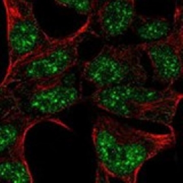 Anti-HOXA6 antibody produced in rabbit，100UL，HPA077900-100UL，Sigma