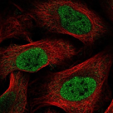 Anti-HOXC6 antibody produced in rabbit，100UL，HPA054981-100UL，Sigma