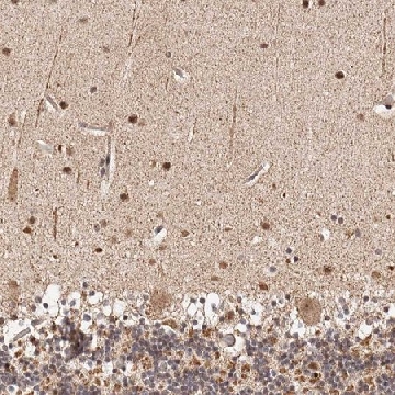 Anti-HIVEP3 antibody produced in rabbit，100UL，HPA005728-100UL，Sigma