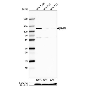 Anti-NMT2 antibody produced in rabbit，100UL，HPA001303-100UL，Sigma
