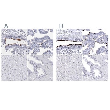 Anti-CCDC181 antibody produced in rabbit，100UL，HPA027275-100UL，Sigma