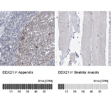 Anti-DDX21 antibody produced in rabbit，100UL，HPA036592-100UL，Sigma
