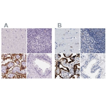 Anti-HSD17B1 antibody produced in rabbit，100UL，HPA065296-100UL，Sigma