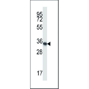 ANTI-MOUSE HOXA11 (CENTER) antibody produced in rabbit，400UL，SAB1304728-400UL，Sigma