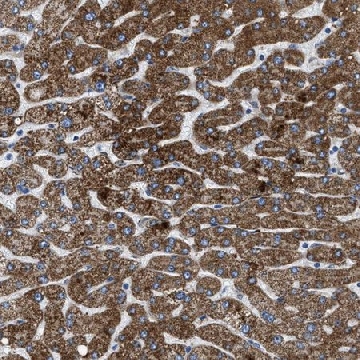 Anti-ILDR1 antibody produced in rabbit，100UL，HPA018207-100UL，Sigma