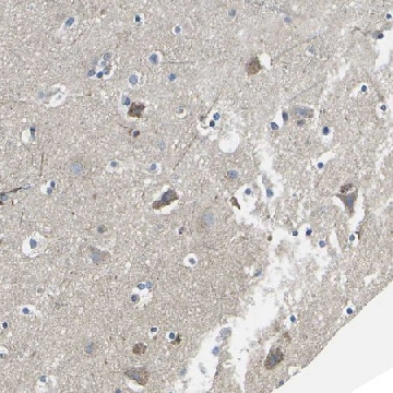 Anti-TMEFF2 antibody produced in rabbit，100UL，HPA015587-100UL，Sigma