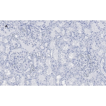 抗-PLA2R1抗体，克隆1D5，ZooMAb®兔单克隆抗体，25UL，ZRB012657-25UL，Sigma