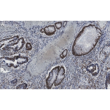 Anti-Phospho-IRF-3-(Ser396) Antibody, clone 2M20 ZooMAb® Rabbit Monoclonal，4X25UL，ZRB1568-4X25UL，Sigma