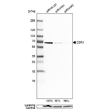 Monoclonal Anti-ESR1 antibody produced in mouse，100UL，AMAB90867-100UL，Sigma